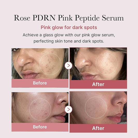 medicube - Sérum Antiedad PDRN Pink Peptide Serum 30 ml